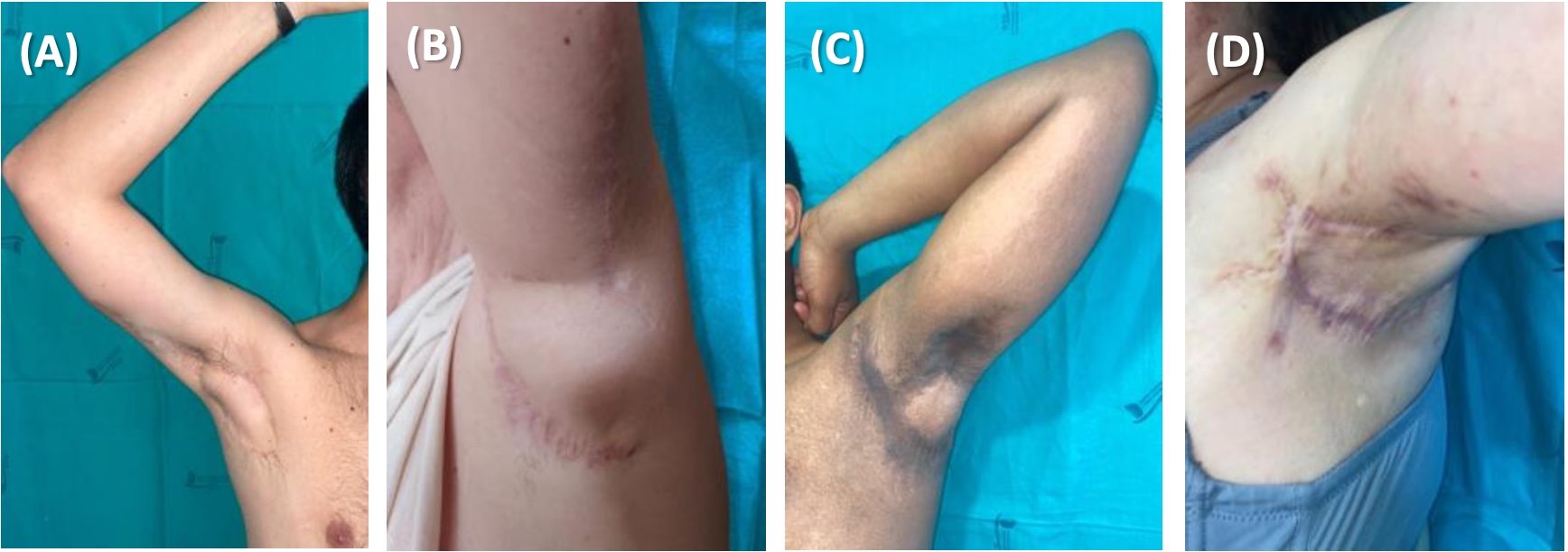 fig_4