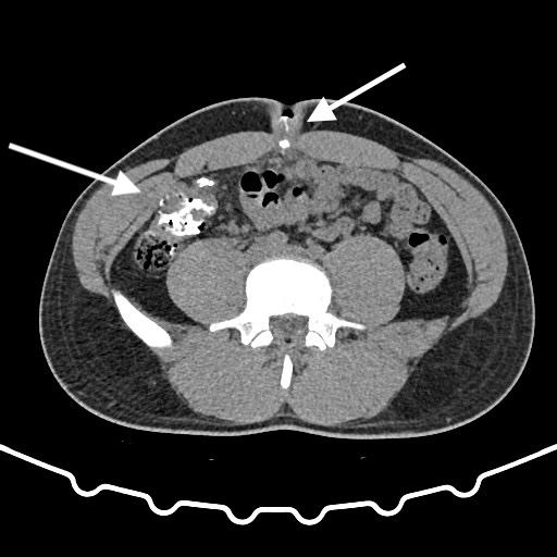 fig1