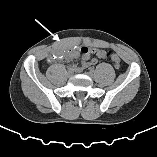 fig2