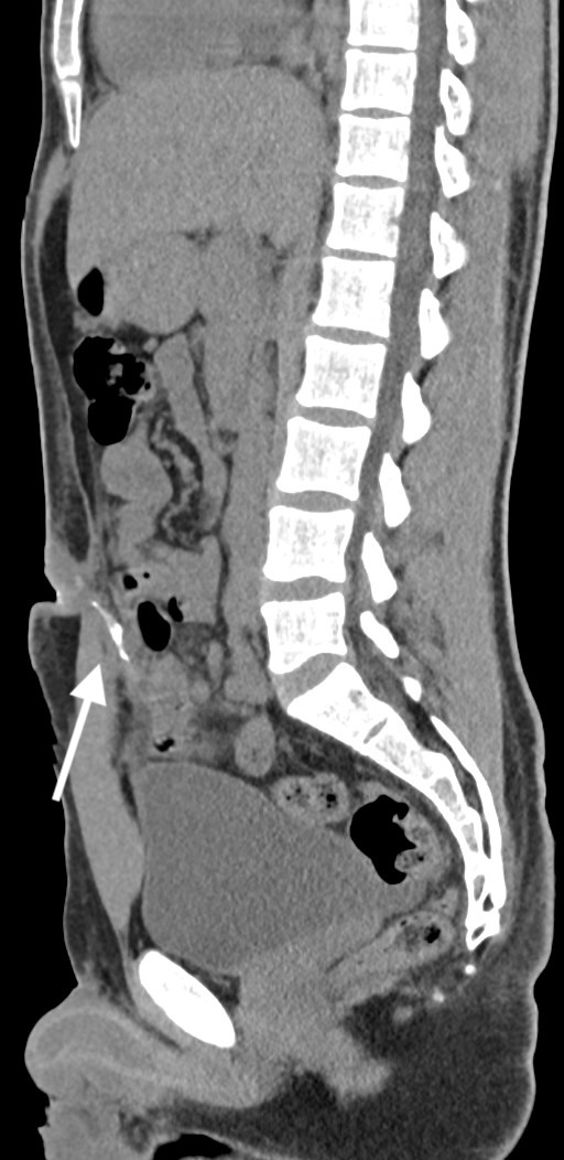fig3